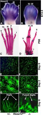 Digits in a dish: An in vitro system to assess the molecular genetics of hand/foot development at single-cell resolution